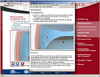 Remicade integrierten Druckfunktion
